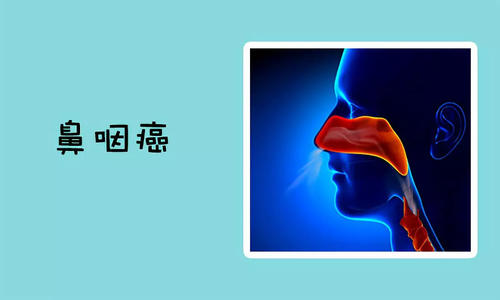 福州中医如何治疗鼻咽癌